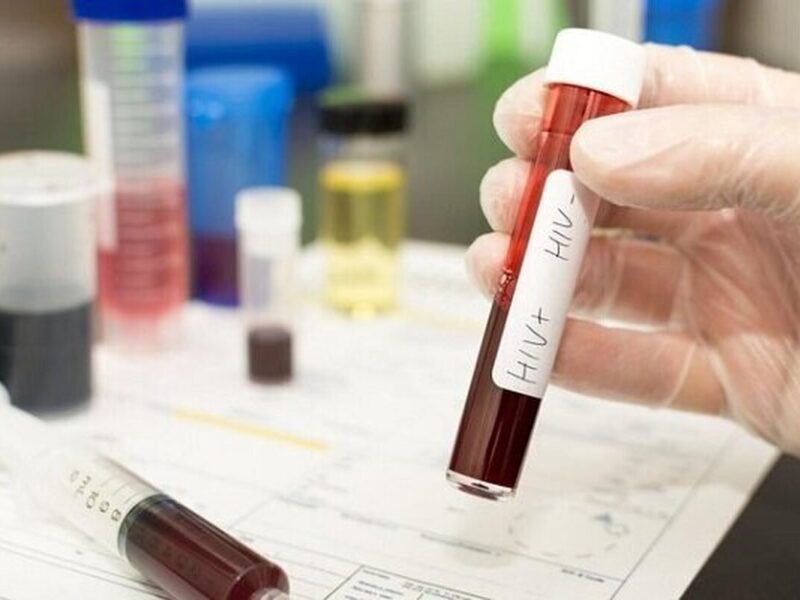 کاهش شیوع HIV در میان معتادان تزریق‌کننده موادمخدر