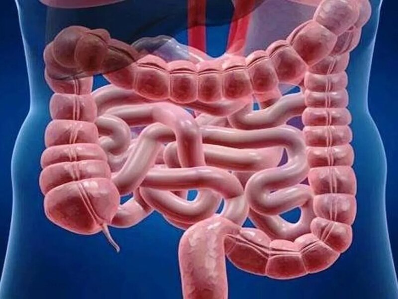 ارتباط میکروبیوم روده با سرطان