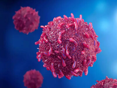 شبکه بهداشت از فزایش ابتلا به آنفلوآنزای فصلی در جنوب تهران خبر داد